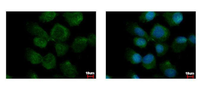 PPM1A Antibody in Immunocytochemistry (ICC/IF)