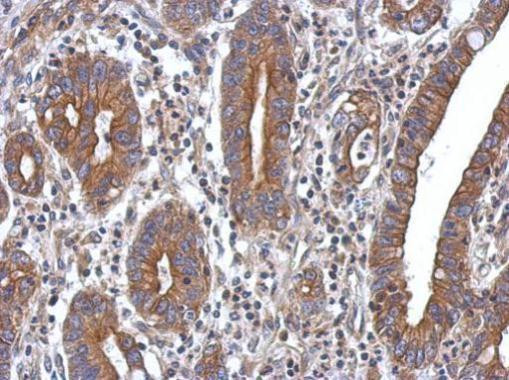 PPM1A Antibody in Immunohistochemistry (Paraffin) (IHC (P))