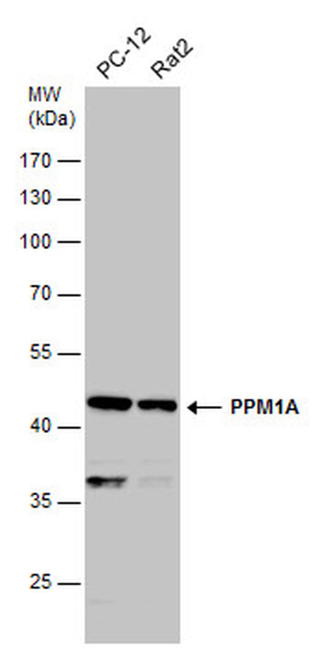 PPM1A Antibody in Western Blot (WB)