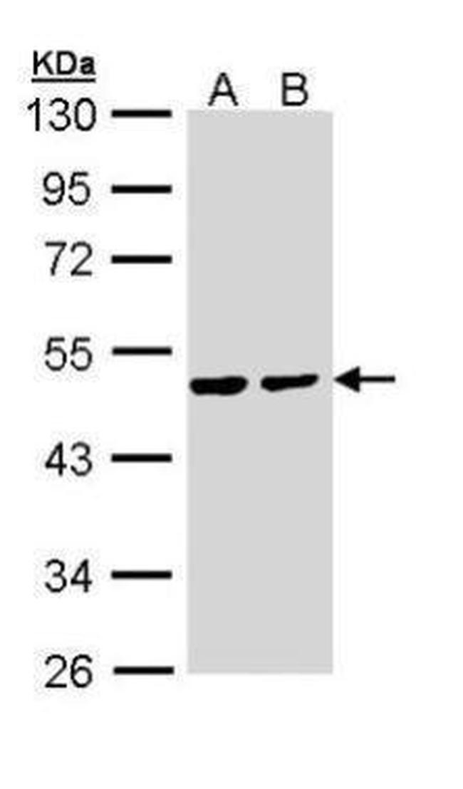 PPM1A Antibody in Western Blot (WB)