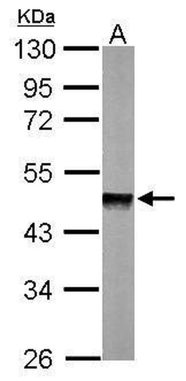 PPM1A Antibody in Western Blot (WB)