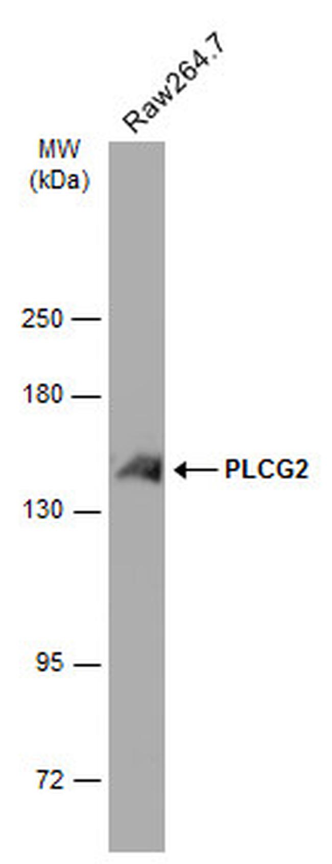 PLCG2 Antibody in Western Blot (WB)