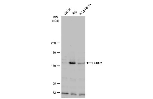 PLCG2 Antibody in Western Blot (WB)