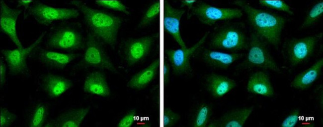 RUVBL1 Antibody in Immunocytochemistry (ICC/IF)