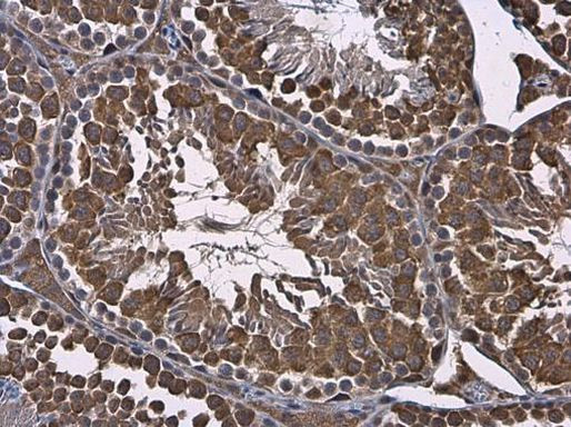 RUVBL1 Antibody in Immunohistochemistry (Paraffin) (IHC (P))