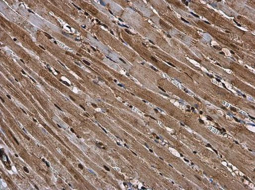 RUVBL1 Antibody in Immunohistochemistry (Paraffin) (IHC (P))