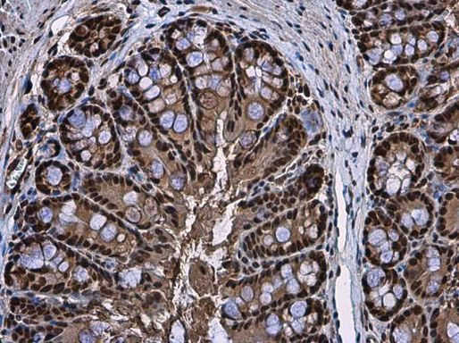 RUVBL1 Antibody in Immunohistochemistry (Paraffin) (IHC (P))