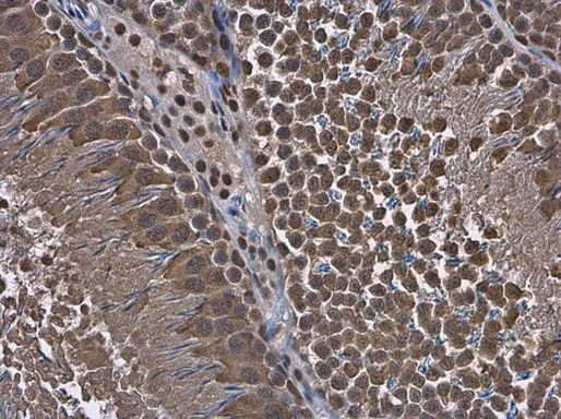 RUVBL1 Antibody in Immunohistochemistry (Paraffin) (IHC (P))