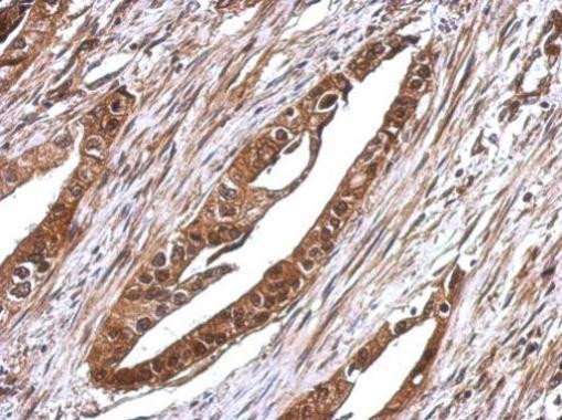 RUVBL1 Antibody in Immunohistochemistry (Paraffin) (IHC (P))