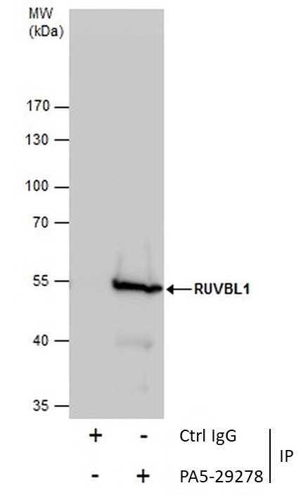 RUVBL1 Antibody in Immunoprecipitation (IP)