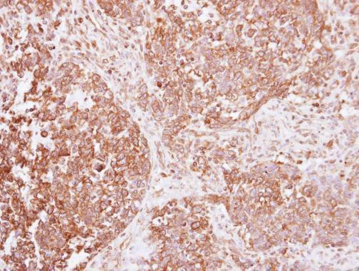 INSR Antibody in Immunohistochemistry (Paraffin) (IHC (P))