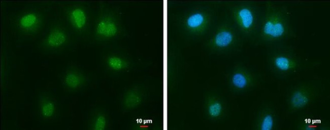 c-Abl Antibody in Immunocytochemistry (ICC/IF)