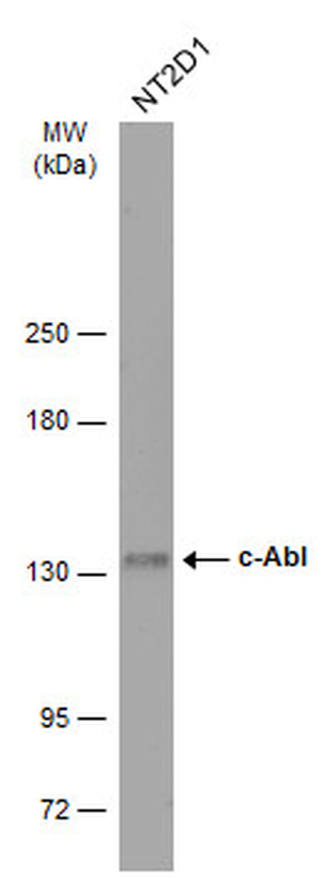 c-Abl Antibody in Western Blot (WB)