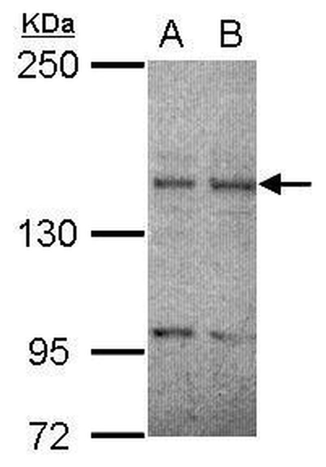 RET Antibody in Western Blot (WB)