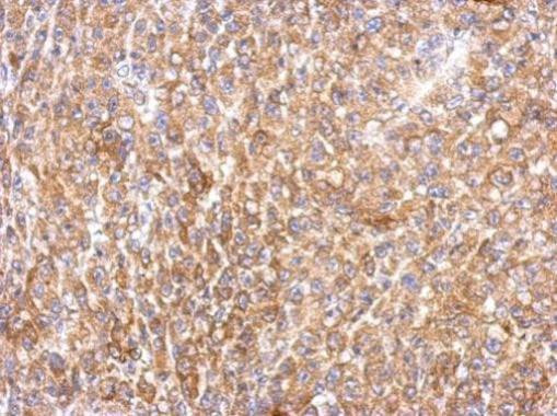 MEK2 Antibody in Immunohistochemistry (Paraffin) (IHC (P))