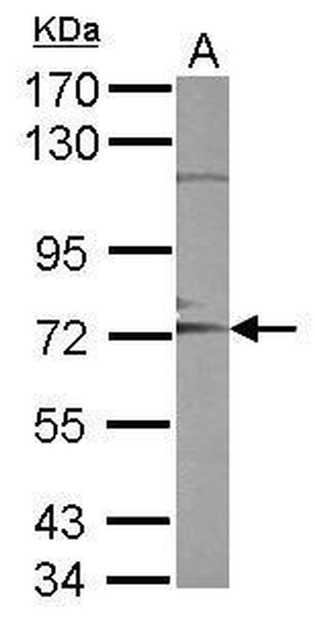 ADAM10 Antibody in Western Blot (WB)