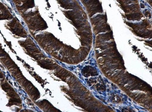 IKK epsilon Antibody in Immunohistochemistry (Paraffin) (IHC (P))