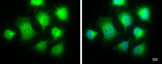 IKK epsilon Antibody in Immunocytochemistry (ICC/IF)