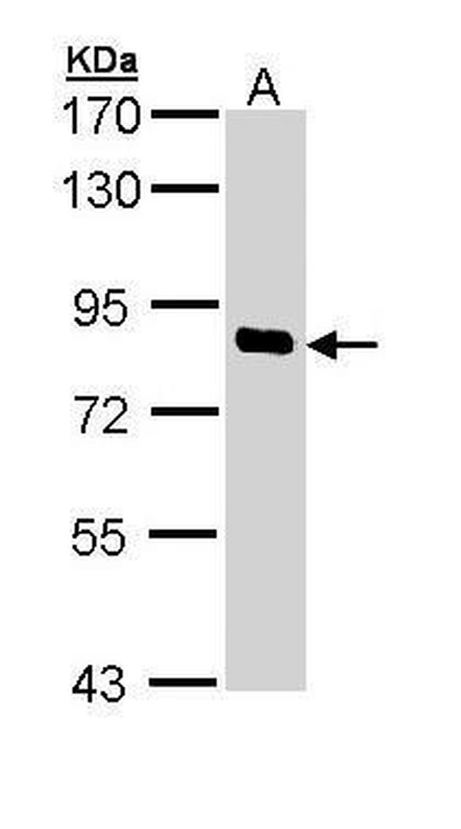 SCYL1 Antibody in Western Blot (WB)