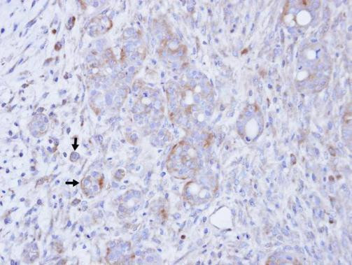 DGKG Antibody in Immunohistochemistry (Paraffin) (IHC (P))