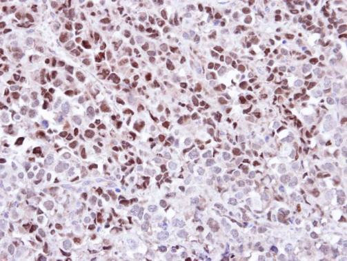 WEE1 Antibody in Immunohistochemistry (Paraffin) (IHC (P))