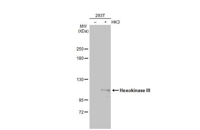 HK3 Antibody in Western Blot (WB)