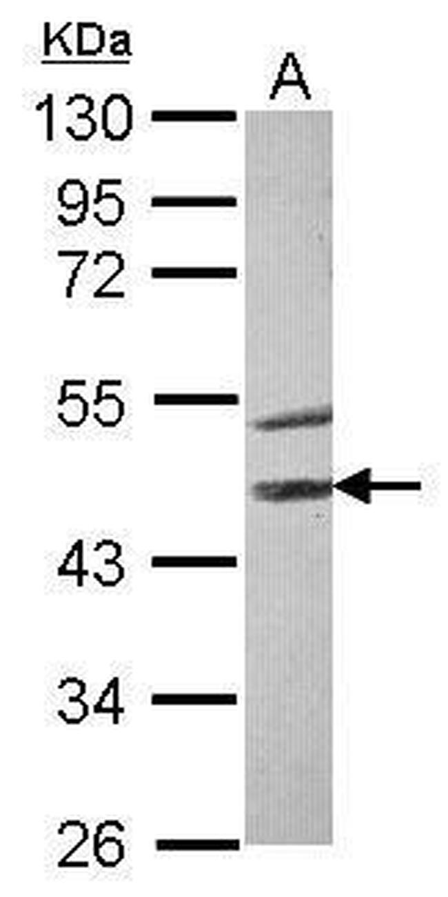 STK40 Antibody in Western Blot (WB)