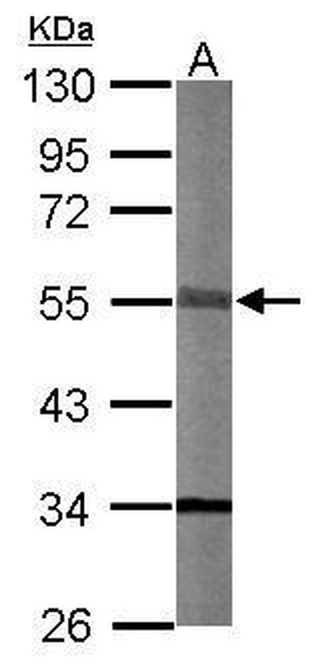 STK40 Antibody in Western Blot (WB)