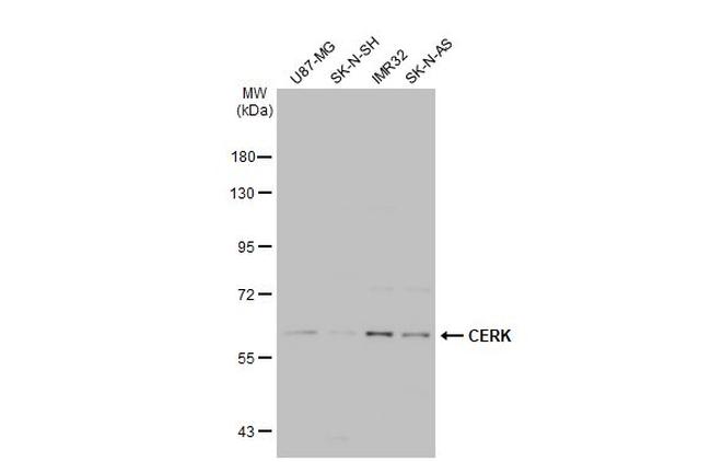 CERK Antibody in Western Blot (WB)