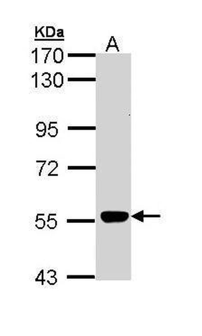 MPP2 Antibody in Western Blot (WB)