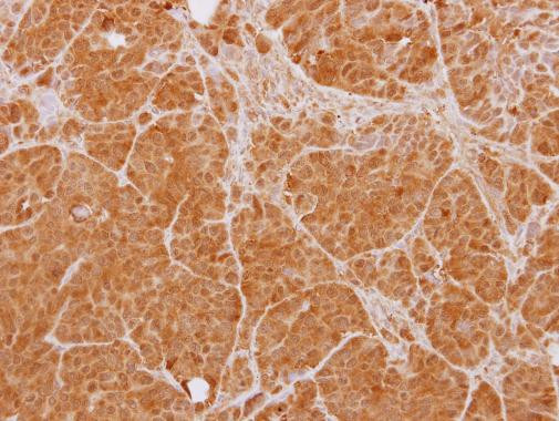 PTK9 Antibody in Immunohistochemistry (Paraffin) (IHC (P))