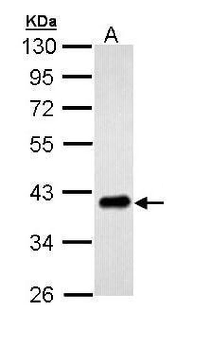 PTK9 Antibody in Western Blot (WB)