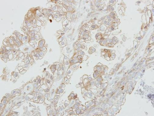 MCK10 Antibody in Immunohistochemistry (Paraffin) (IHC (P))