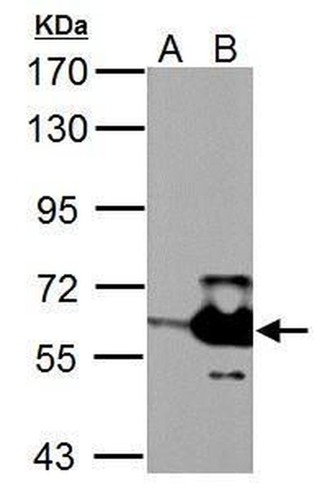 MST2 Antibody in Western Blot (WB)