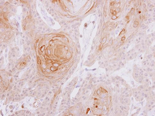 MYLK2 Antibody in Immunohistochemistry (Paraffin) (IHC (P))