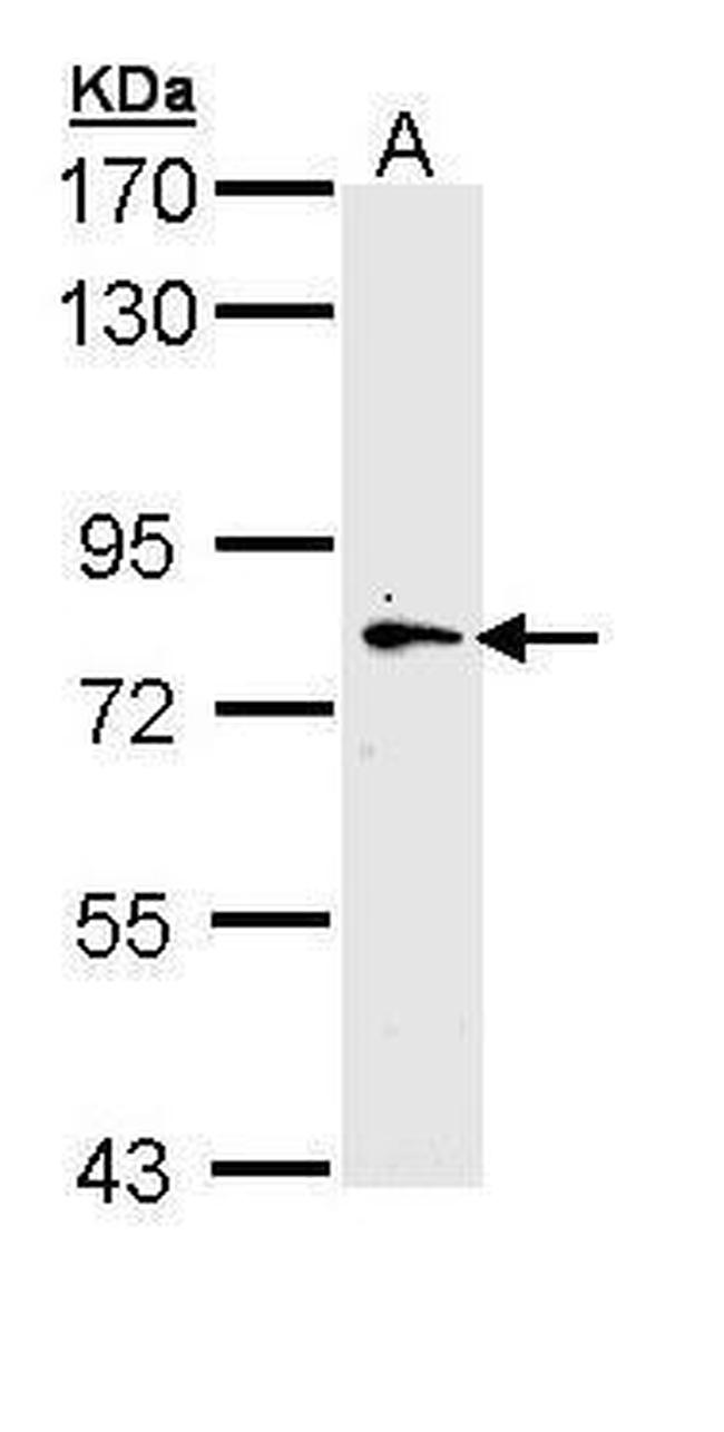 MYLK2 Antibody in Western Blot (WB)