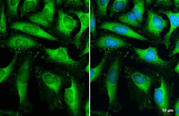 HK2 Antibody in Immunocytochemistry (ICC/IF)