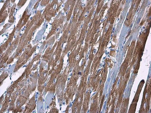 HK2 Antibody in Immunohistochemistry (Paraffin) (IHC (P))