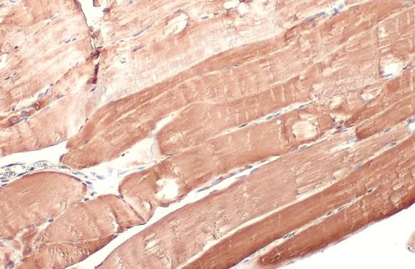 HK2 Antibody in Immunohistochemistry (Paraffin) (IHC (P))