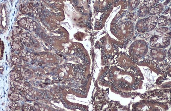 HK2 Antibody in Immunohistochemistry (Paraffin) (IHC (P))