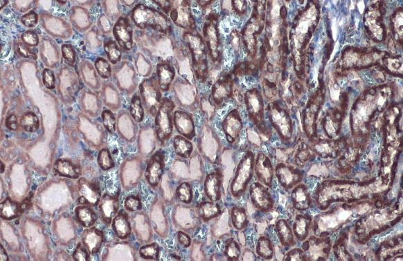 HK2 Antibody in Immunohistochemistry (Paraffin) (IHC (P))