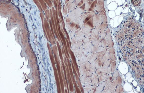 HK2 Antibody in Immunohistochemistry (Paraffin) (IHC (P))