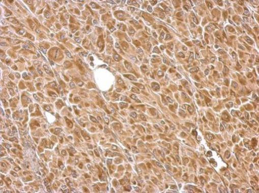 HK2 Antibody in Immunohistochemistry (Paraffin) (IHC (P))