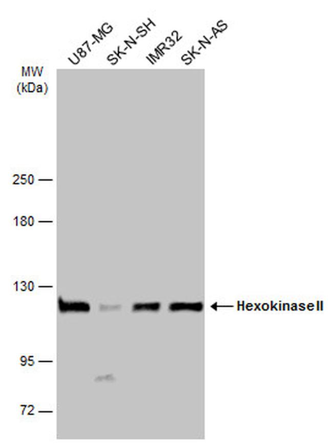 HK2 Antibody in Western Blot (WB)