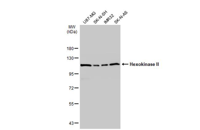 HK2 Antibody in Western Blot (WB)