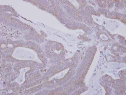 MARK3 Antibody in Immunohistochemistry (Paraffin) (IHC (P))