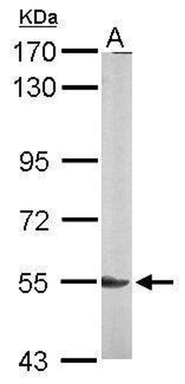 Lyn Antibody in Western Blot (WB)