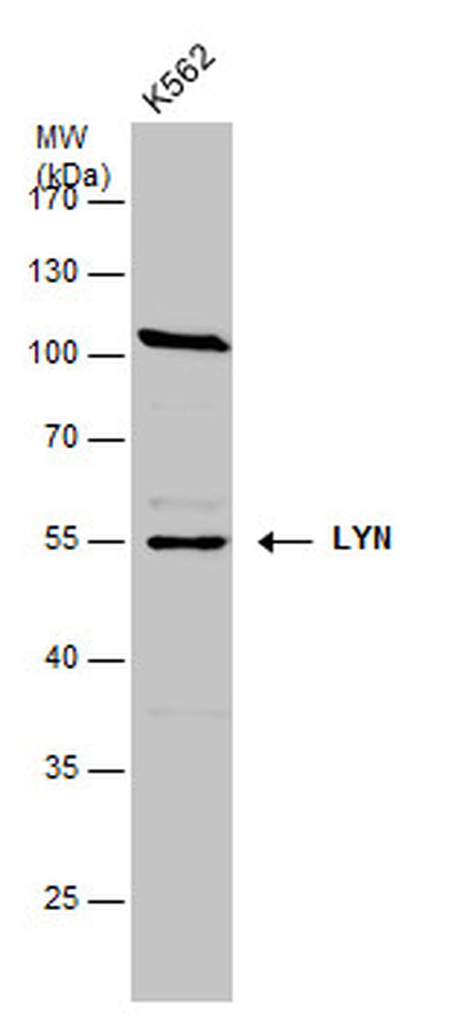 Lyn Antibody in Western Blot (WB)