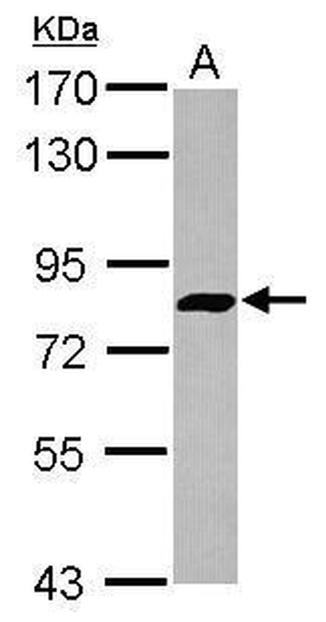 ADAP Antibody in Western Blot (WB)