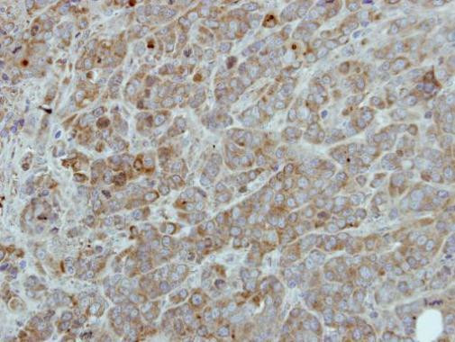 c-Raf Antibody in Immunohistochemistry (Paraffin) (IHC (P))